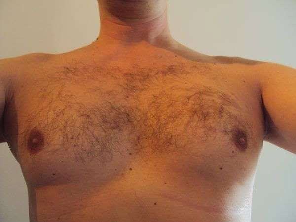 Me hairy