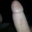 Erect2