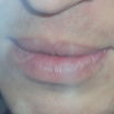First photo