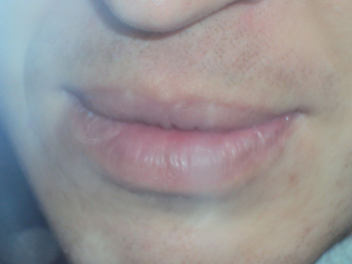 First photo