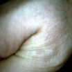 First photo