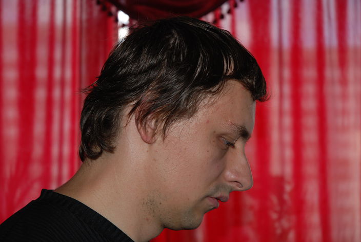 рсо